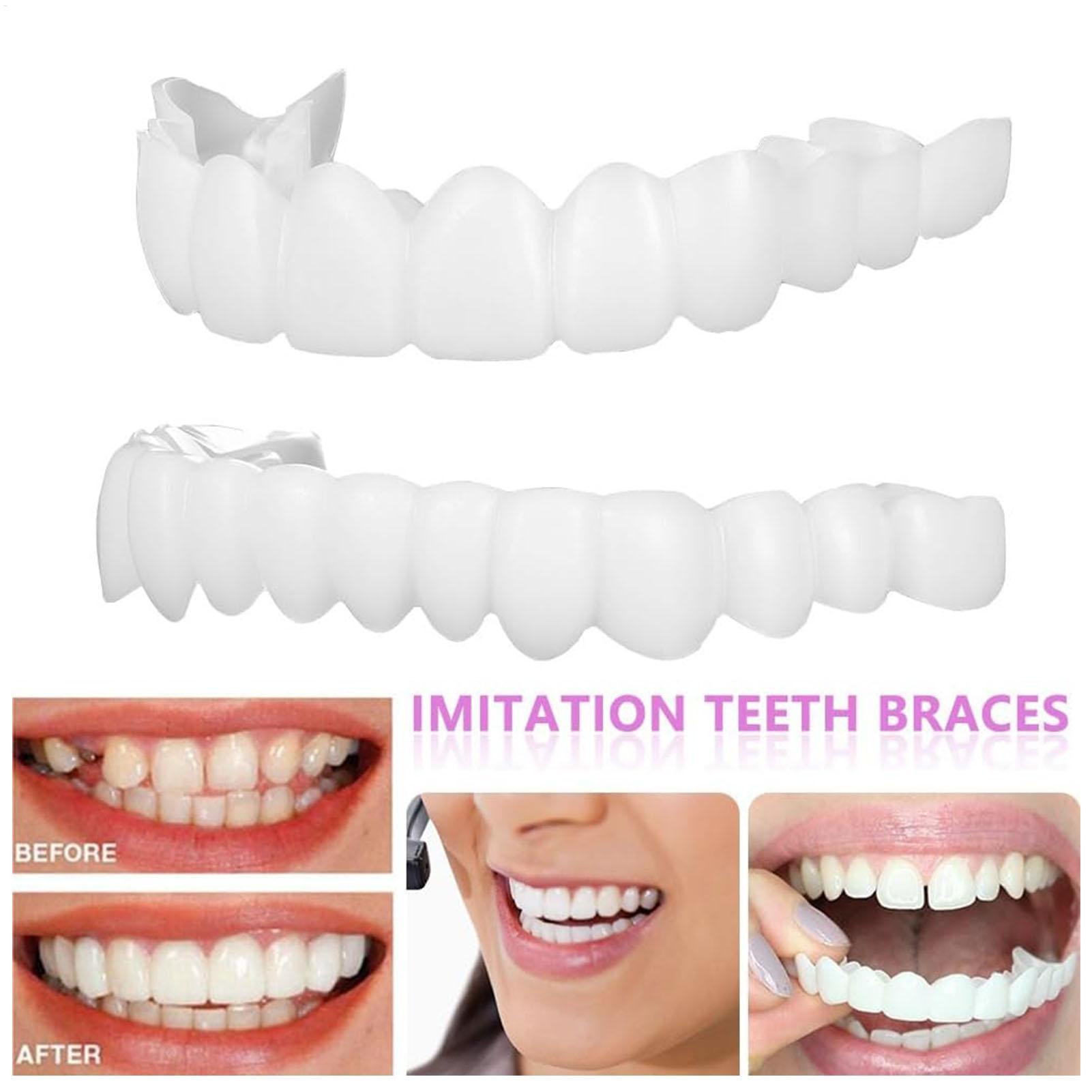 Teeth Whitening With Braces - Prothèses dentaires supérieures et inférieures, couvre-dents