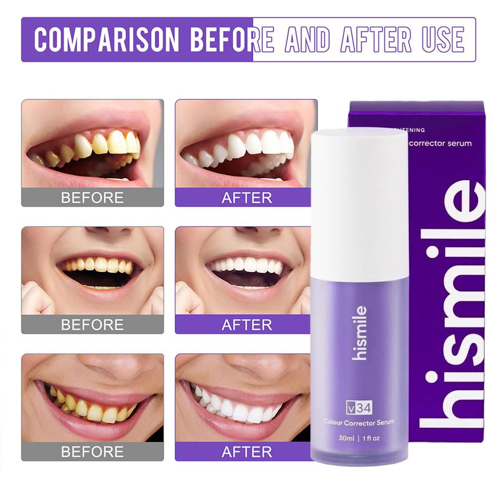 Teeth Whitening Crest - 30ml Hismile V34 Mousse blanchissante pour