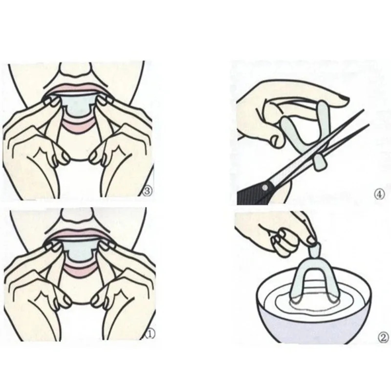 1/3/6 paires de protège-dents  - Teeth Whitening With Braces avis et prix