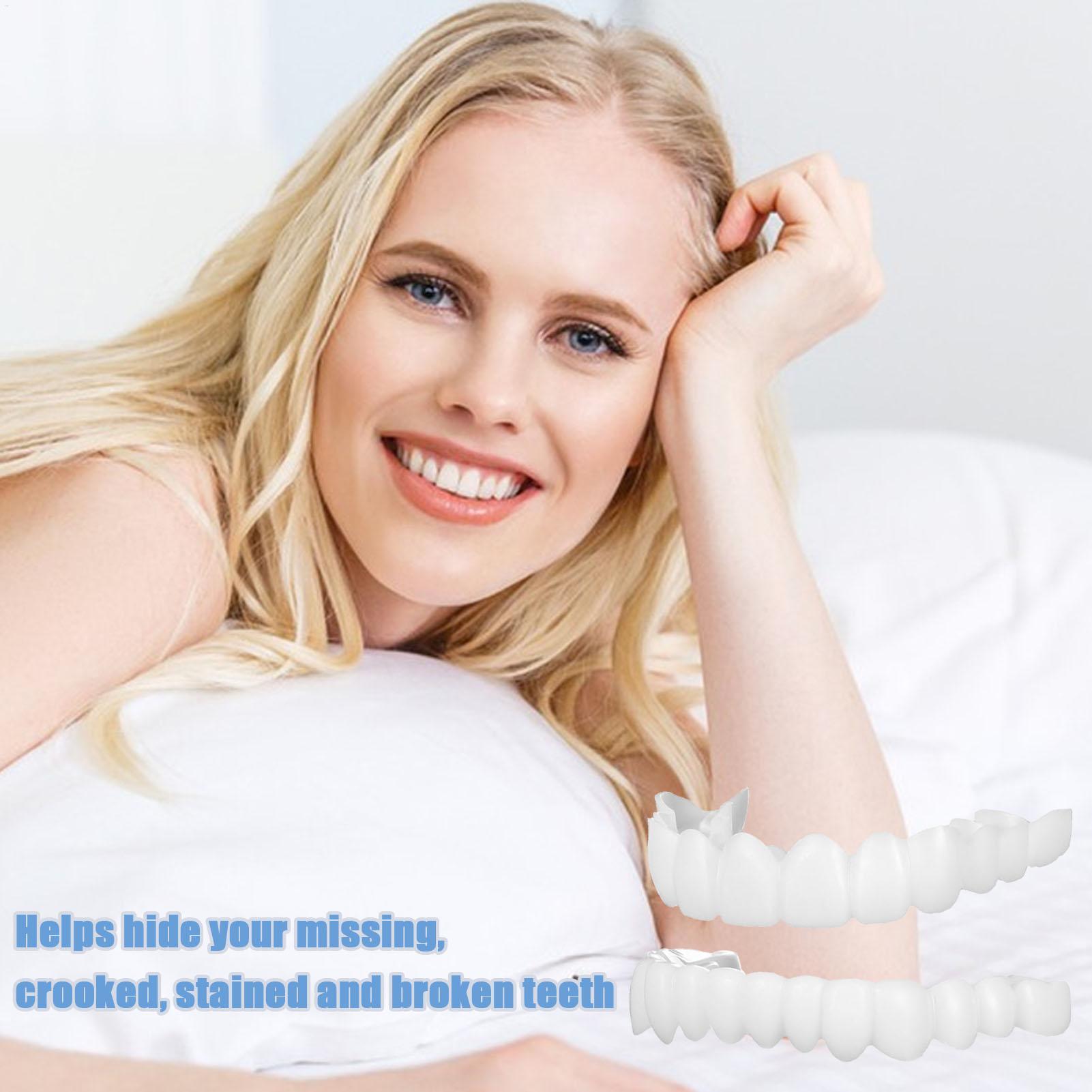 Prothèses dentaires supérieure - Teeth Whitening With Braces avis et prix