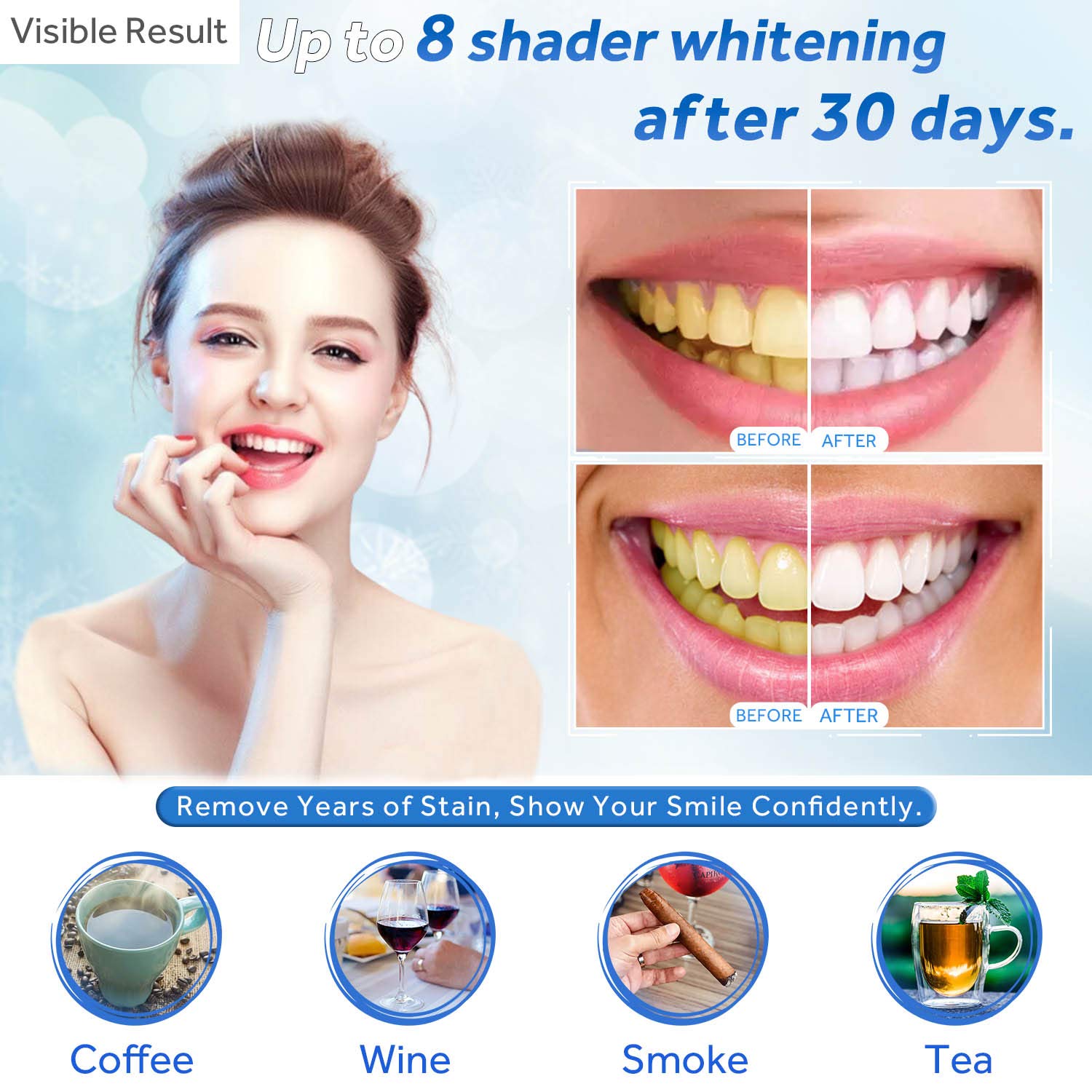 Gel de blanchiment des dents r - Teeth Whitening Gels Used By Dentists avis et prix