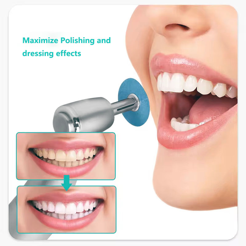 Disques de polissage dentaire, - Teeth Whitening Express avis et prix