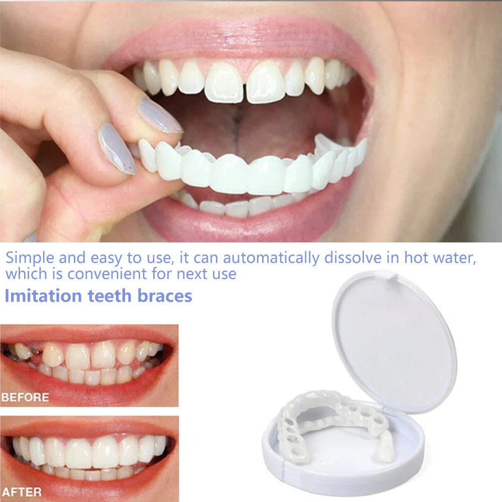 Sdottor faux dents bretelles a - Teeth Whitening With Braces avis et prix