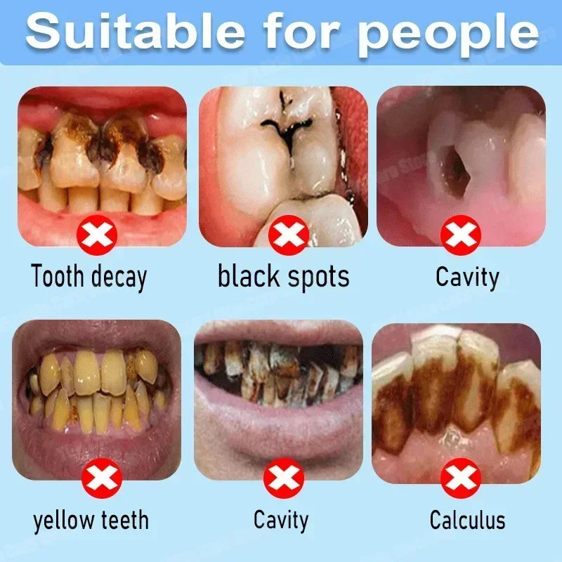 Dentifrice anti-caries : répar - Teeth Whitening Uv avis et prix