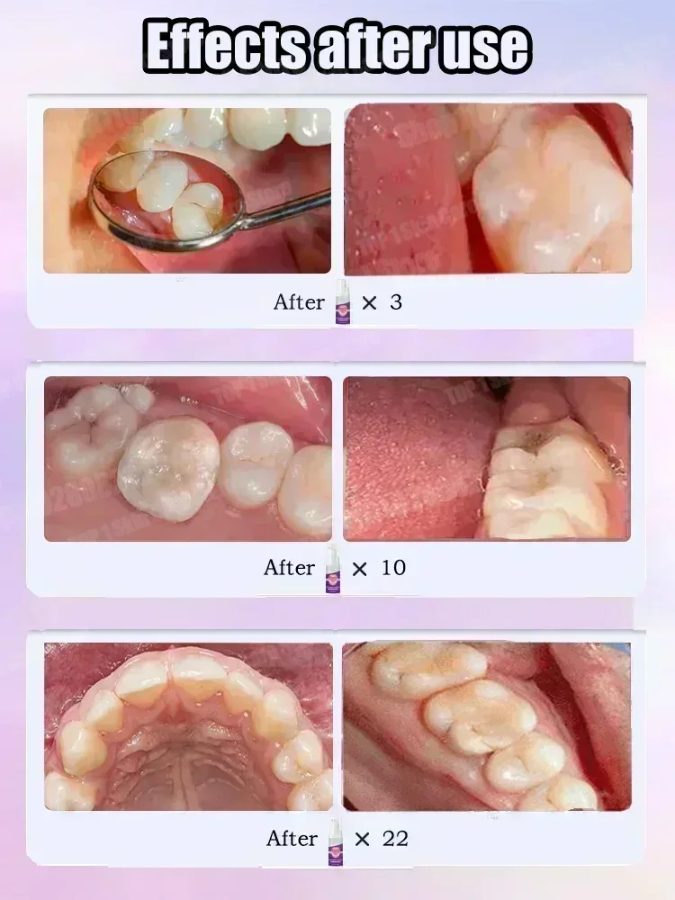 Offres spéciales Best-seller,  - Teeth Whitening Toothpaste avis et prix