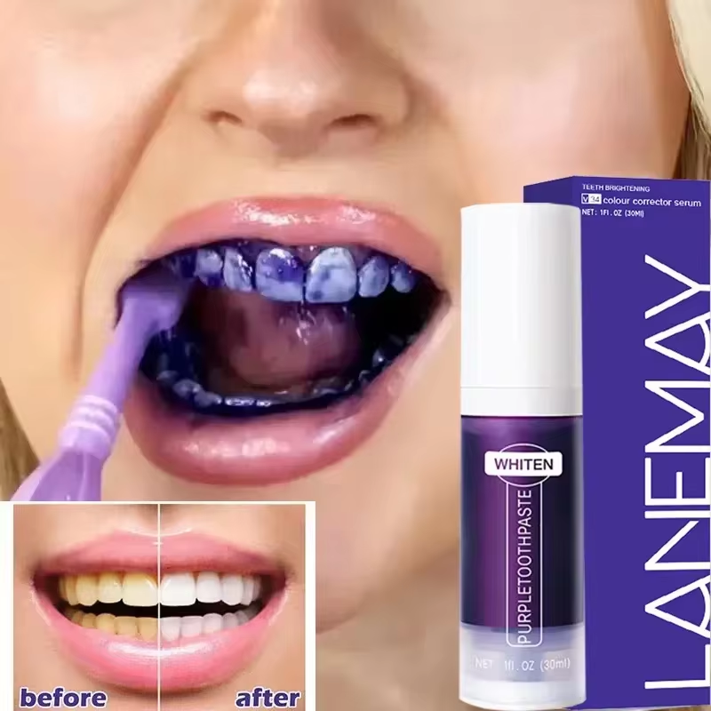V34 violet blanchiment des den - Teeth Whitening Crest avis et prix